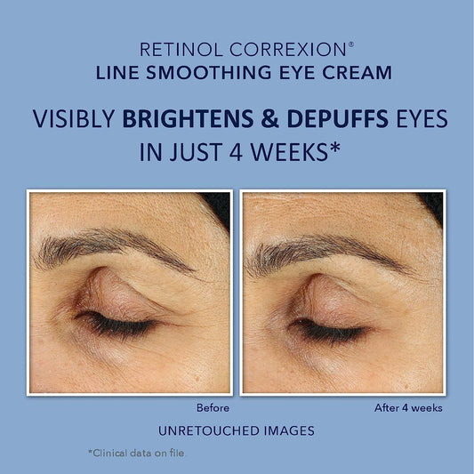 RoC Retinol Correxion Value Set Duo, Deep Wrinkle Anti-Aging Night Face Cream + Daily Under Eye Cream for Dark Circles & Puffiness, Moisturizer