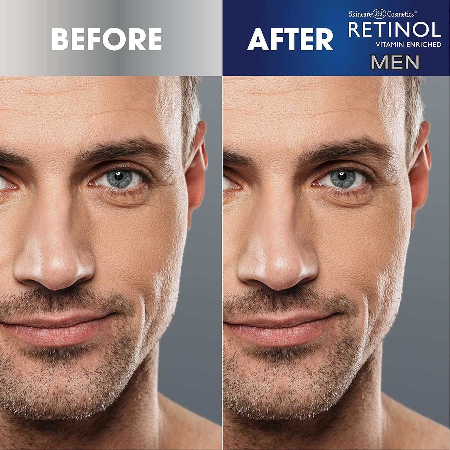 Esupli.com Retinol Men’s Anti-Wrinkle Facial Serum – The Original Retin